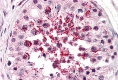 Immunohistochemistry-Paraffin: ADAM20 Antibody [NBP3-14530] - Immunohistochemistry of formalin-fixed, paraffin-embedded human testis after heat-induced antigen retrieval.